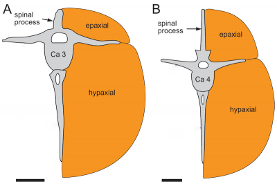 A transverse section illustrating epaxial and hypaxial muscular regions