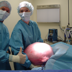 50 lb uterine leiomyoma in a 10-year old potbellied pig. Photo: Dr. K. Mozzachio