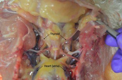 Inspect the thyroid glands near the base of the heart.