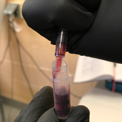 Remove the needle hub from the syringe before transferring blood to the anticoagulant tube to reduce the risk of hemolysis of large, fragile chelonian erythrocytes.