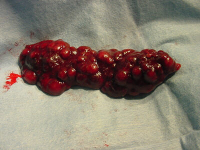 Gross splenic lymphoma in a ferret. Photo credit: Dr. Ruth Boll