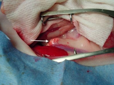 Enlarged right adrenal gland (arrow). Photo credit: Dr. Peter Fisher