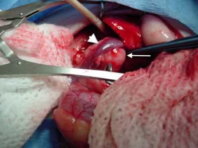 Enlarged right adrenal gland. Photo credit: Dr. Peter Fisher