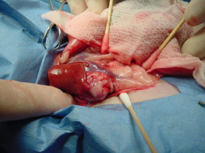Large right adrenal tumor. Photo credit: Dr. Peter Fisher