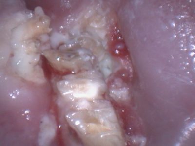 Vista endoscópica de un conejo con un absceso y material purulento en la cavidad oral
