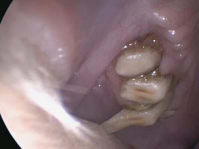 Vista endoscópica de un conejo con sobrecrecimiento dental que podría obstaculizar la intubación orotraqueal