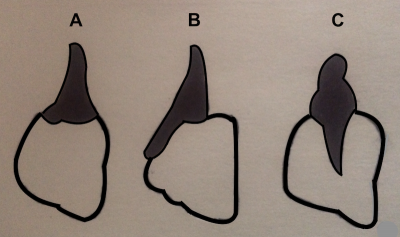 Diagrams of the three common types of dental attachment in reptiles. (A) acrodont (B) pleurodont (C) thecodont
