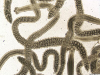 Gross appearance of the tapeworm
