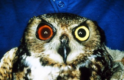 Hyphema