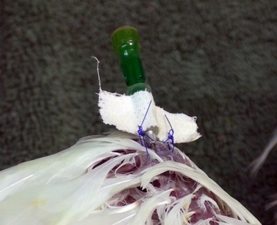 Secure the catheter using butterfly tape and suture