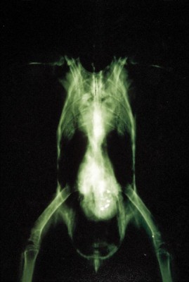 Lead xray showing metal density
