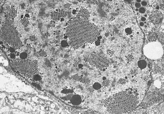 Transmission electron micrograph of adenoviral paracrystalline arrays in Pogona henrylawsoni 