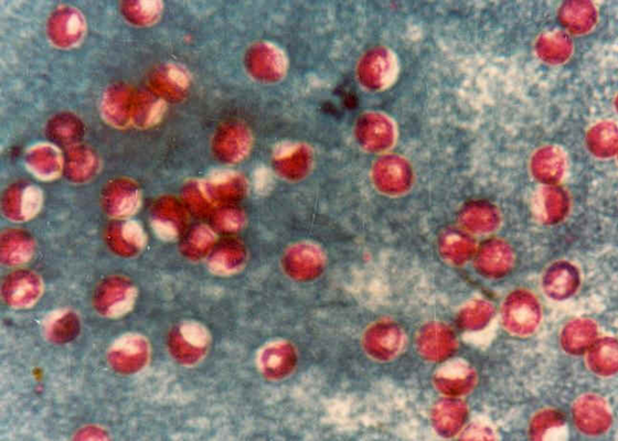Ziehl-Neelson staining of Cryptosporidium. 