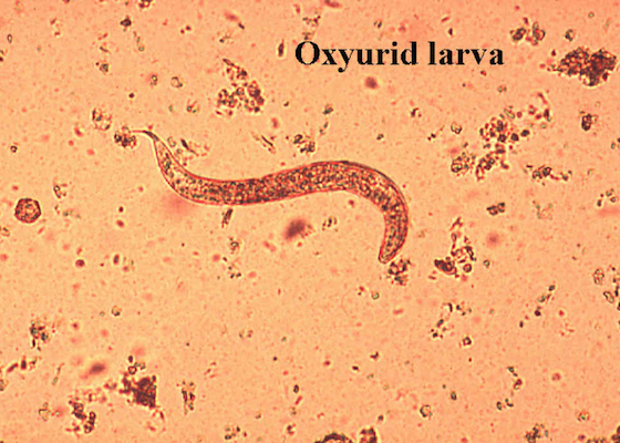 Oxyurid larva