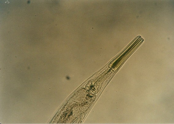 Anterior end of pinworm