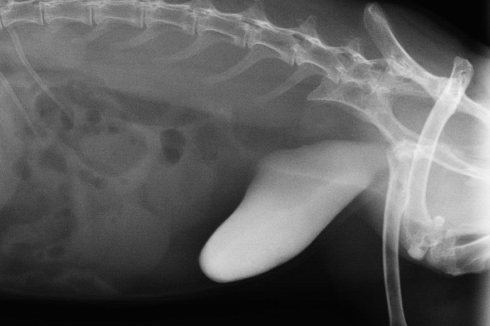 exces de calcium dans le corps exces de calcium dans le corps