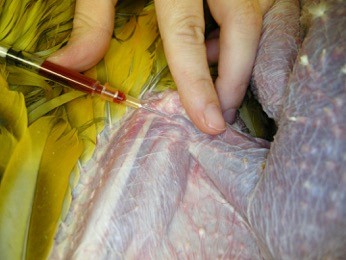 Lors du prélèvement de sang à partir de la veine basilique, l’aiguille est insérée médialement au point juste proximal au coude