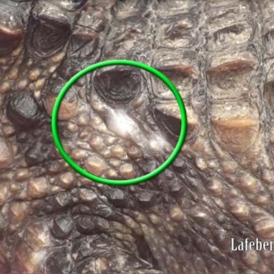 In rare instances, repeated intramuscular injections can lead to skin depigmentation.