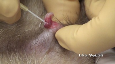 Dilating the urethra