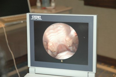 Endoscopic view