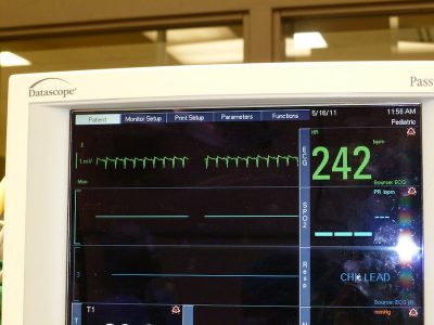 Electrocardiography tracing in a rat