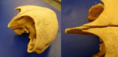 Creptitus or movement upon palpation of the occipital protuberance may be the only physical sign of a skull fracture in the sea turtle